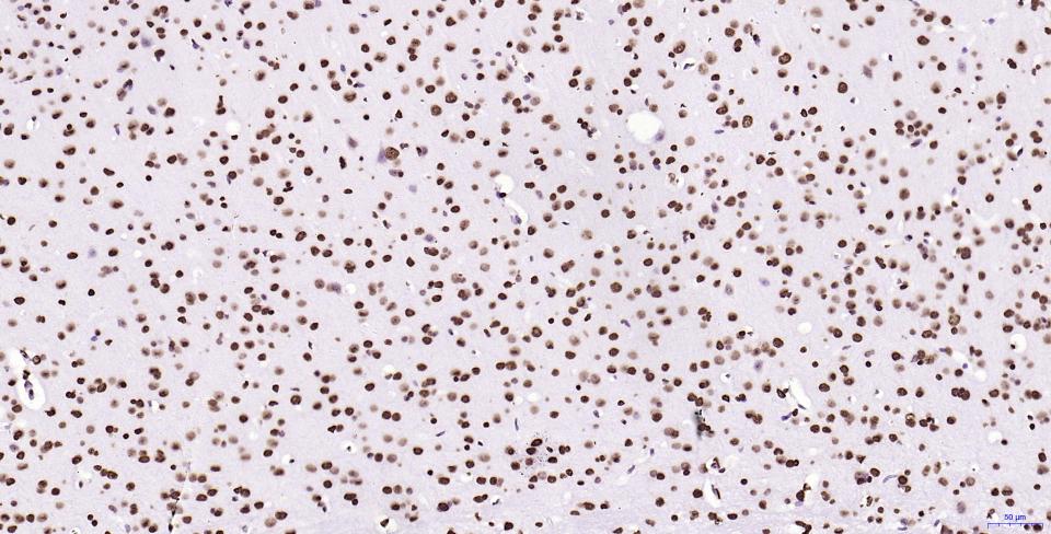 组蛋白H2AX重组兔单抗