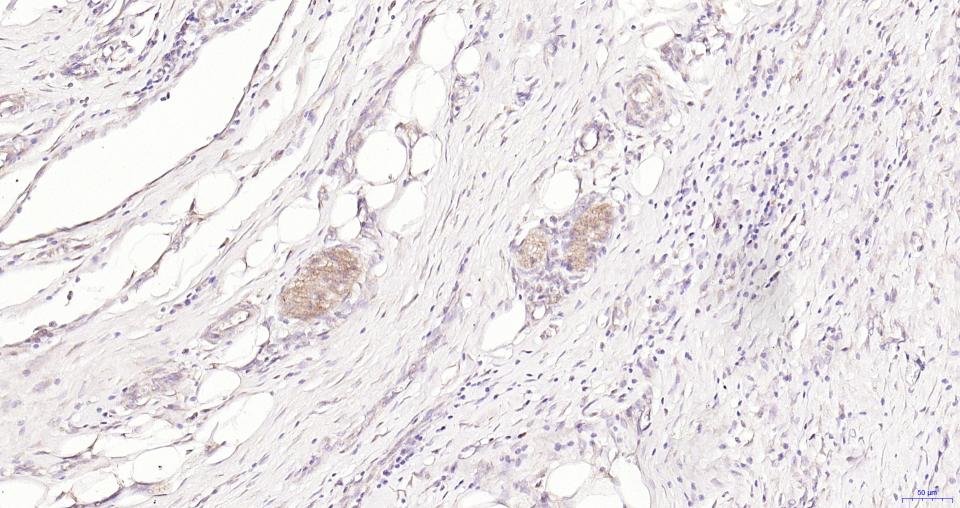小鼠抗人CD56 (NCAM)单克隆抗体-bsm-30046M