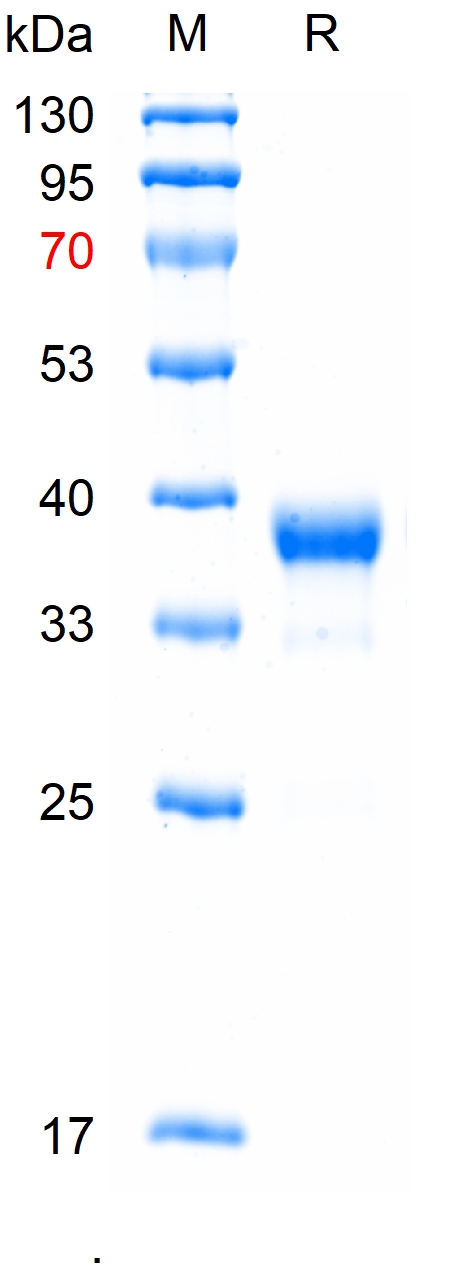 Recombinant human Caspase-3 protein，N-His (重组蛋白) | Bioss