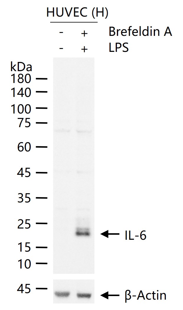 IL-6 Rabbit pAb (一抗) | Bioss