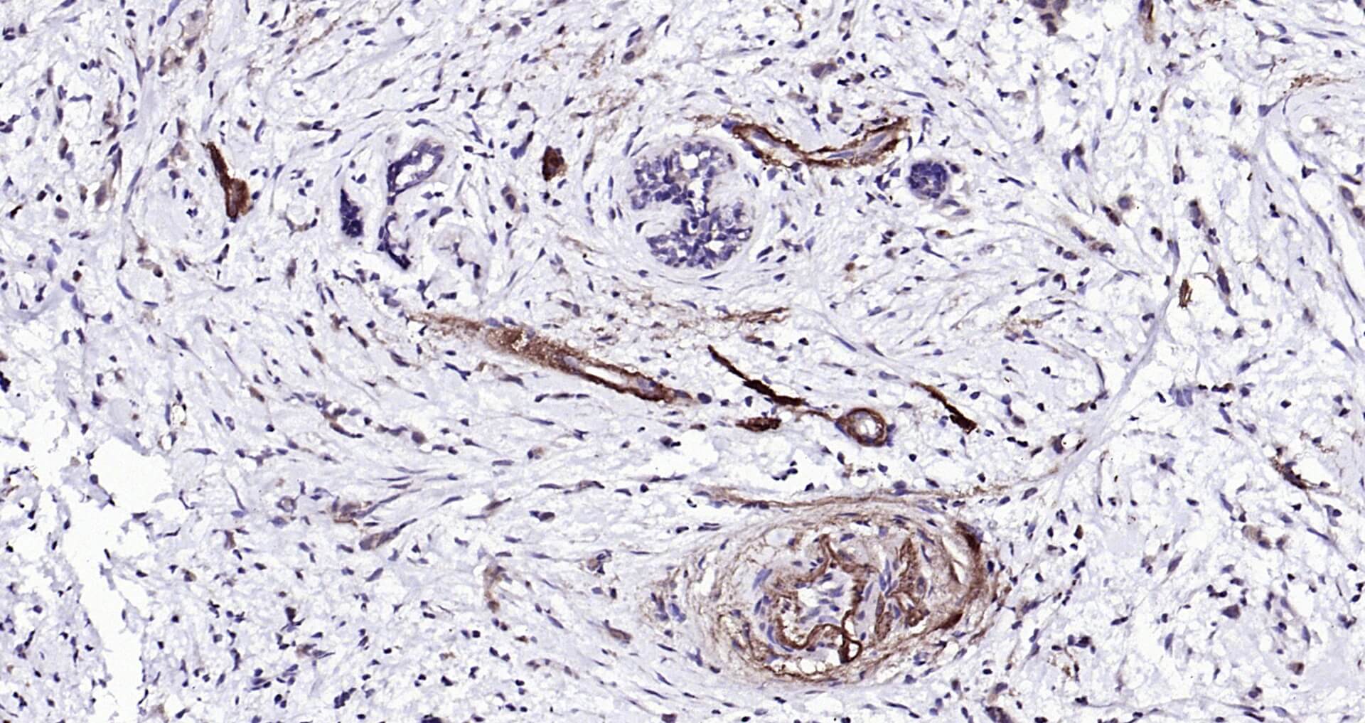 Peripherin Ready-To-Use IHC Kit (免疫组化试剂盒) | Bioss
