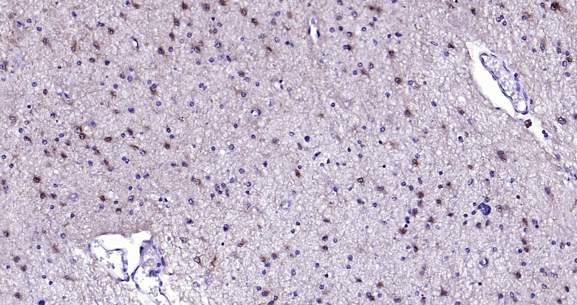S100B Ready-To-Use IHC Kit (免疫组化试剂盒) | Bioss