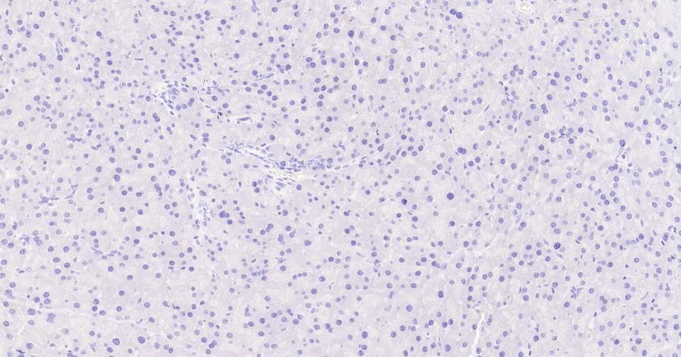 胶原蛋白17重组兔单抗