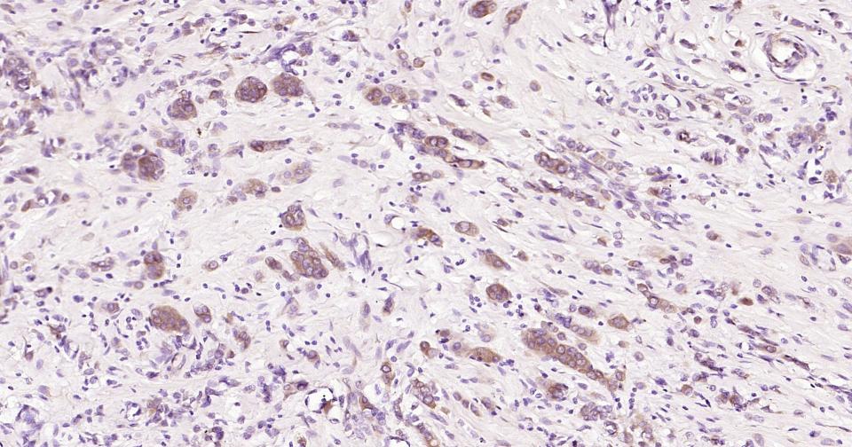 β微管蛋白单克隆抗体-bsm-33120M
