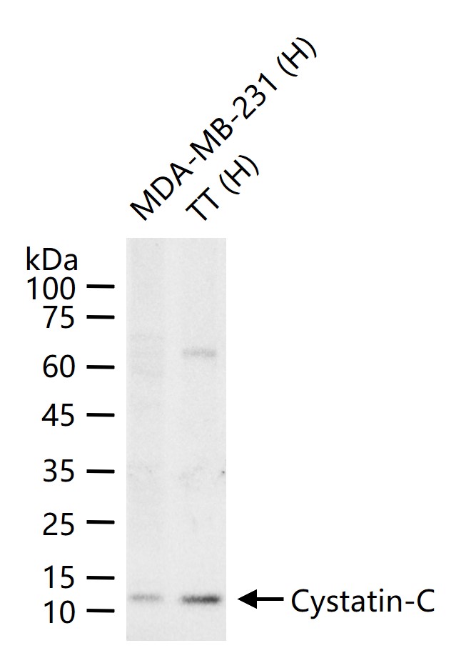 Cystatin-C Mouse mAb (一抗) | Bioss
