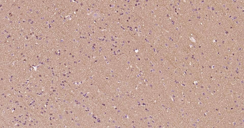 β微管蛋白单克隆抗体-bsm-33120M