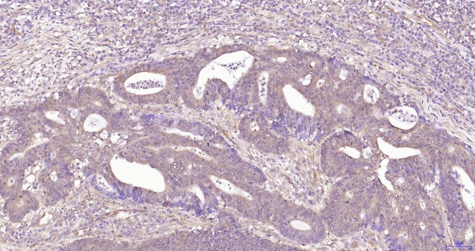 丝裂原活化蛋白激酶1重组兔单抗