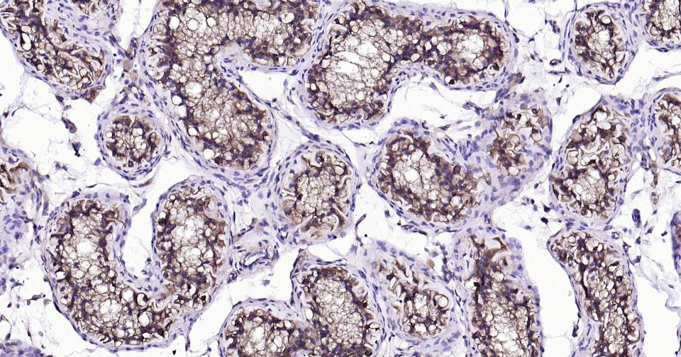 微管蛋白β tubulin/Tubulin β（内参）单克隆抗体-bsm-33034M