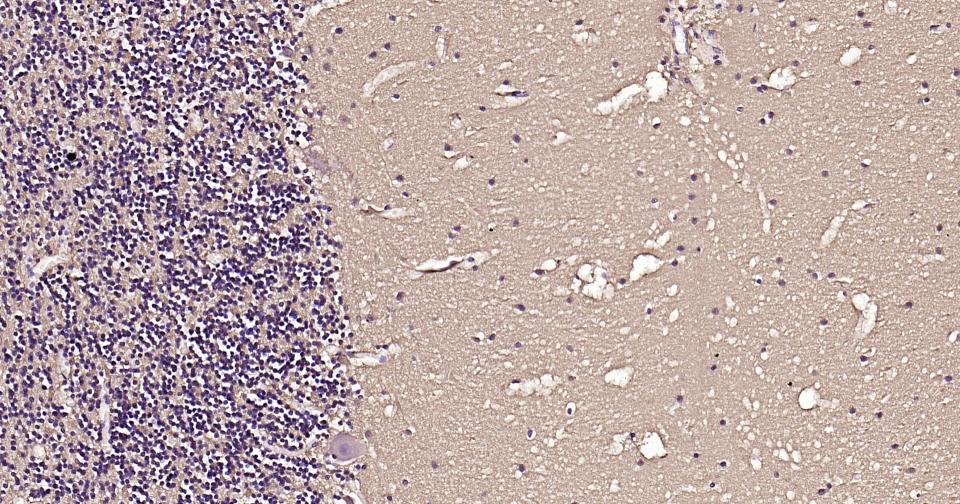 微管蛋白重组兔单抗