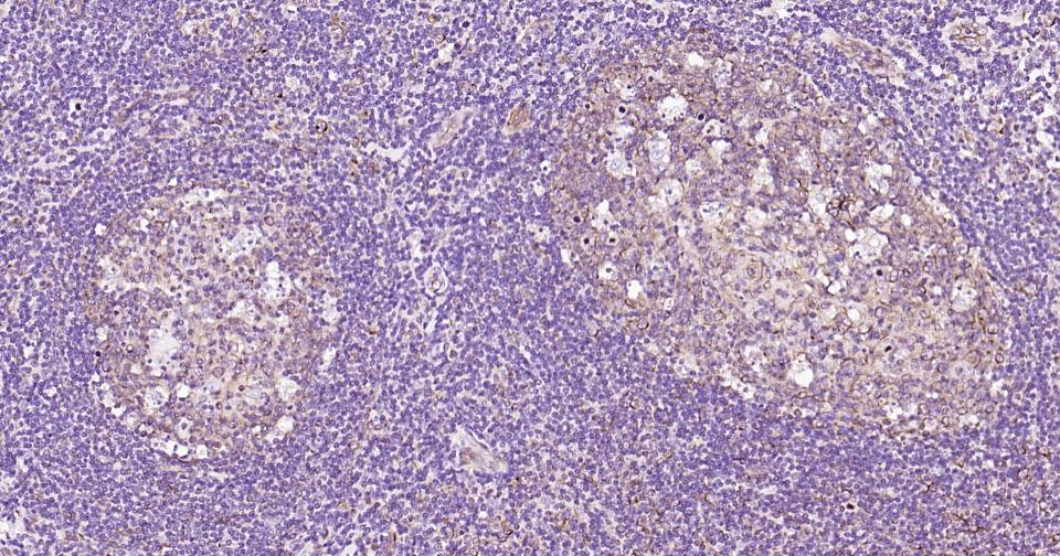 β微管蛋白单克隆抗体-bsm-33120M