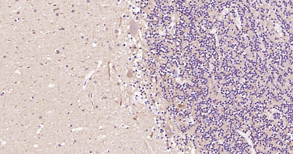 β微管蛋白单克隆抗体-bsm-33120M