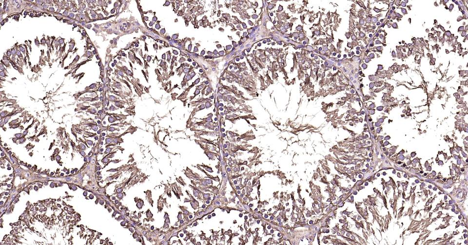 微管蛋白重组兔单抗