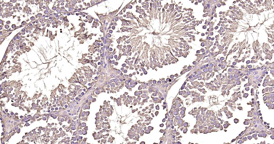 微管蛋白重组兔单抗