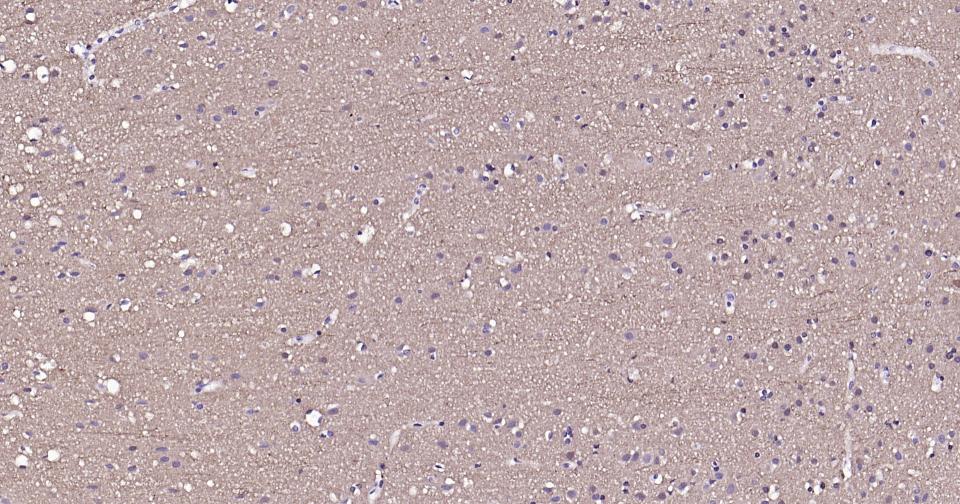 微管蛋白β tubulin/Tubulin β（内参）单克隆抗体-bsm-33034M