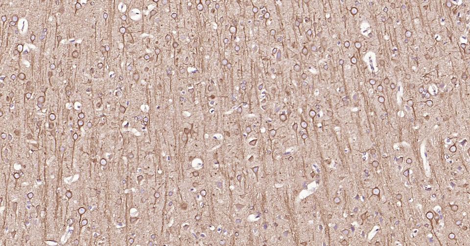 β微管蛋白单克隆抗体-bsm-33120M
