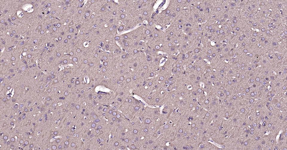 微管蛋白重组兔单抗