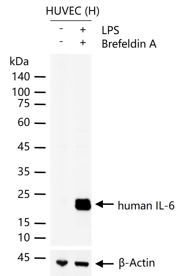 Human IL-6 Mouse mAb (一抗) - WB,IHC-P,IHC-F,IF | Bioss