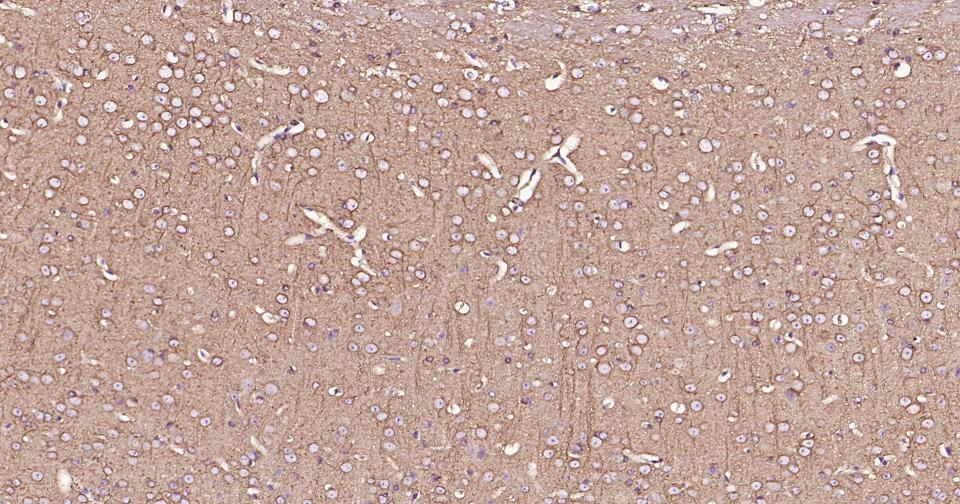 β微管蛋白单克隆抗体-bsm-33120M