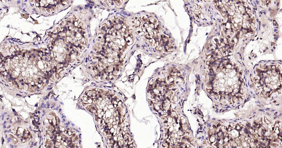 微管蛋白β tubulin/Tubulin β（内参）抗体-bs-4511R