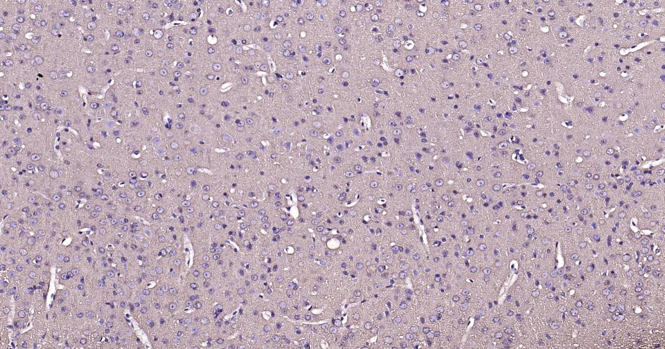 微管蛋白重组兔单抗