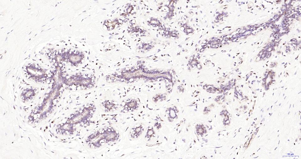 丝裂原活化蛋白激酶1重组兔单抗