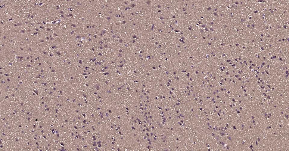 微管蛋白重组兔单抗