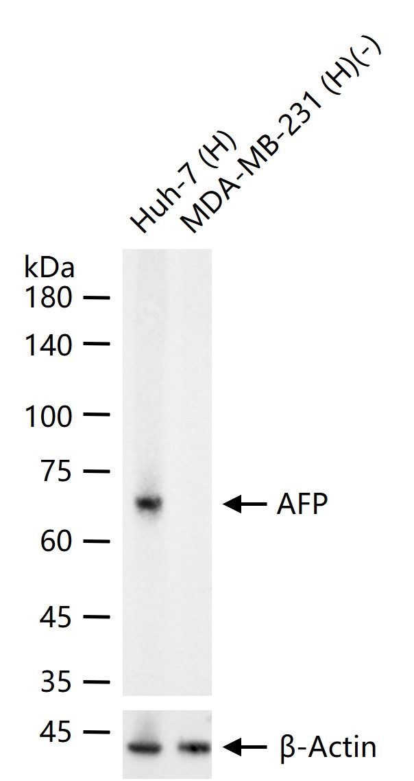 甲胎蛋白重组兔单克隆抗体