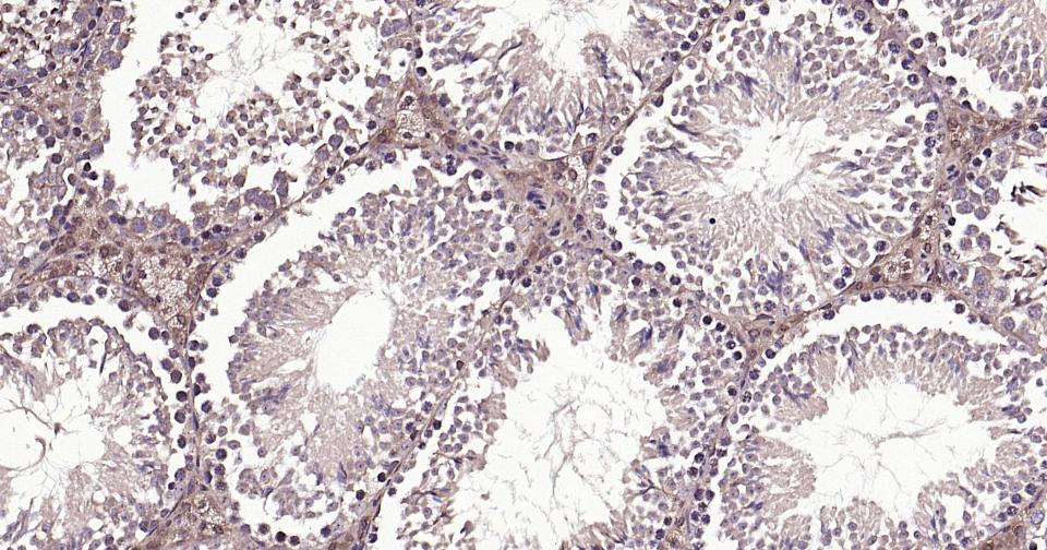 微管蛋白β tubulin/Tubulin β（内参）抗体-bs-4511R