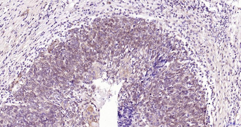原癌基因Yes相关蛋白1重组兔单抗