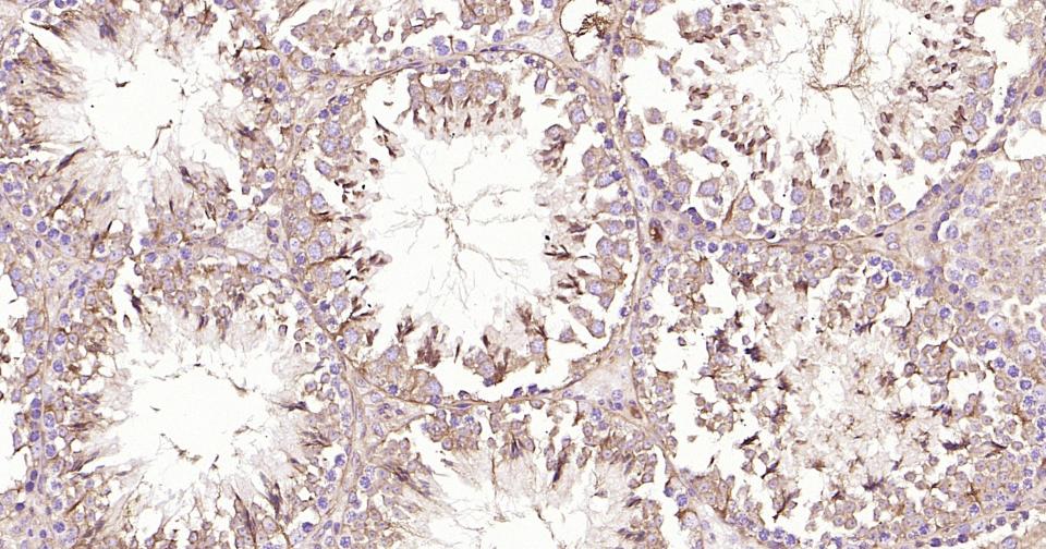 β微管蛋白单克隆抗体-bsm-33120M