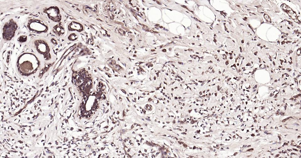 微管蛋白β tubulin/Tubulin β（内参）抗体-bs-4511R