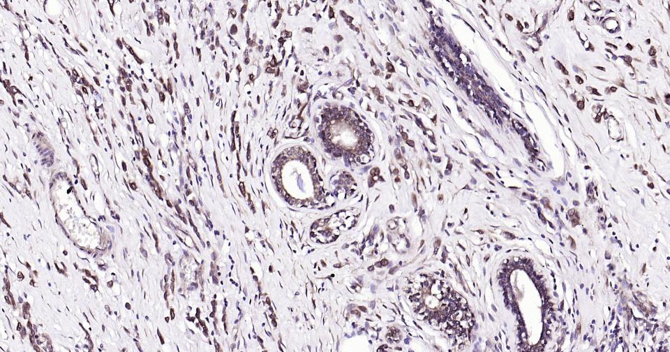 微管蛋白β tubulin/Tubulin β（内参）单克隆抗体-bsm-33034M