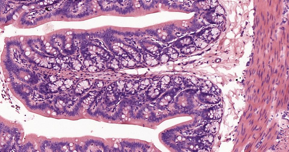 Eosin Y solution  (染色液) | Bioss