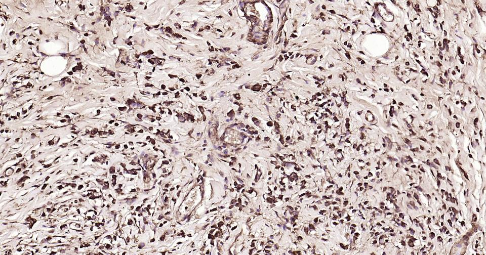 微管蛋白重组兔单抗