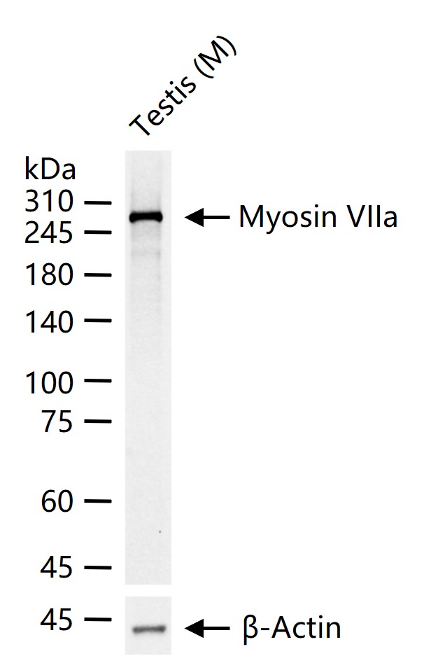 肌球蛋白7a/常染色体隐性耳聋蛋白2重组兔单抗
