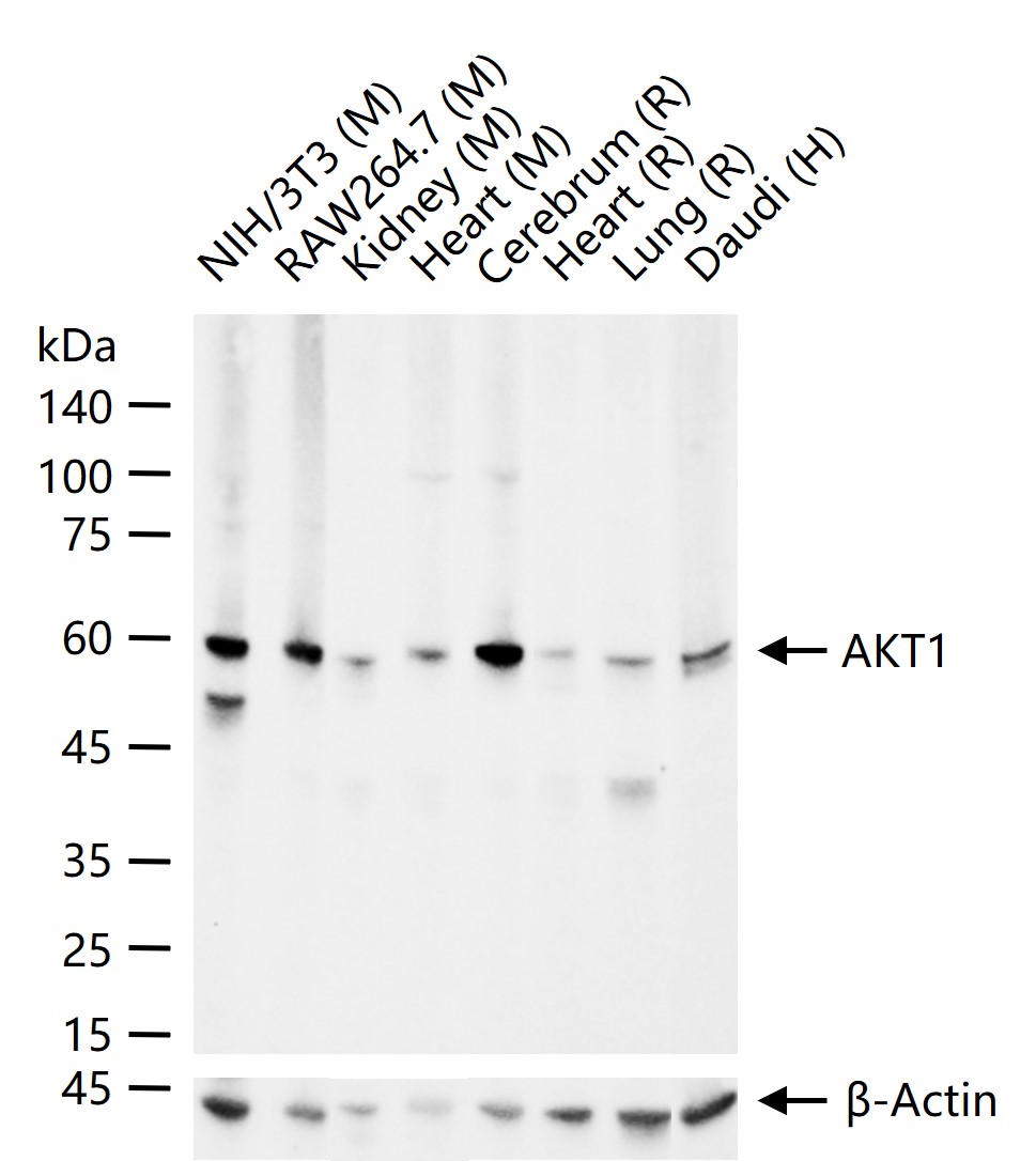 蛋白激酶B重组兔单抗