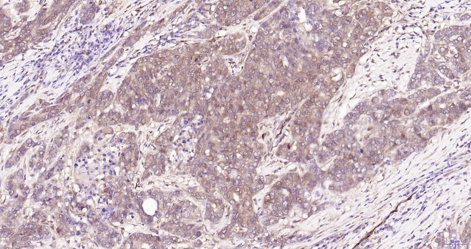 丝裂原活化蛋白激酶1重组兔单抗