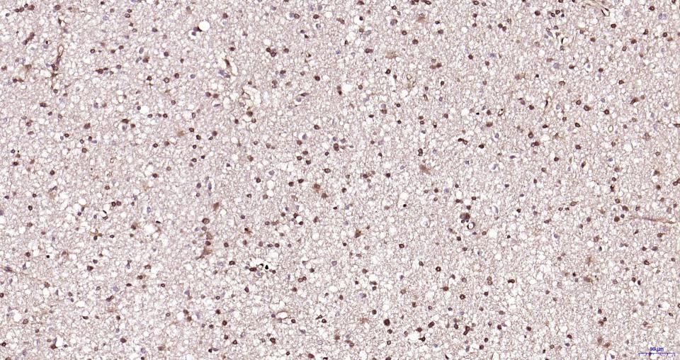 丝裂原活化蛋白激酶1重组兔单抗