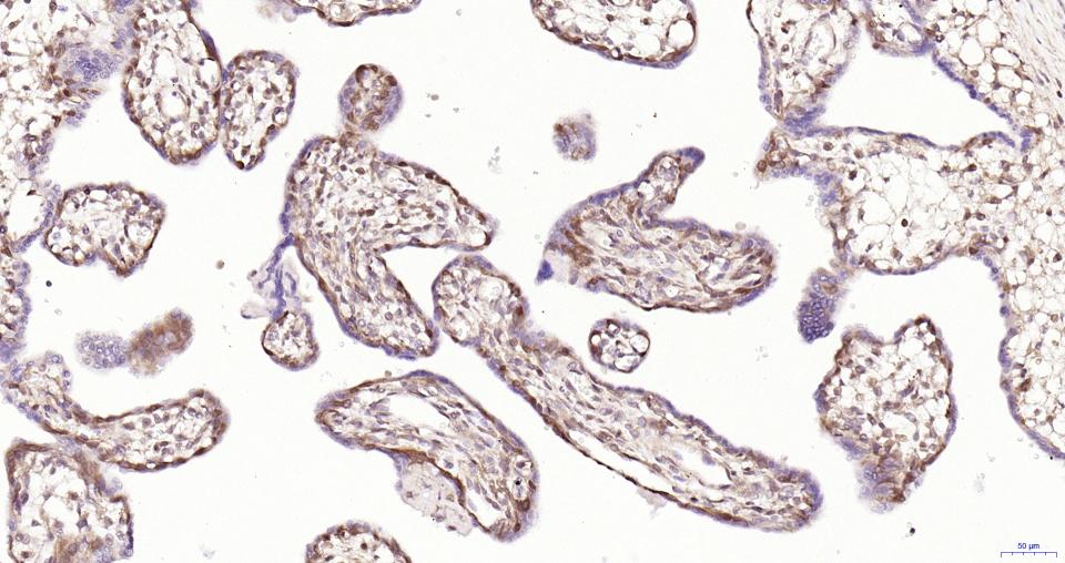 丝裂原活化蛋白激酶1重组兔单抗