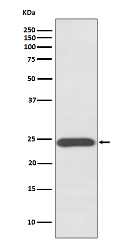 GH1 Recombinant Rabbit mAb (一抗) - WB,IHC-P,IHC-F,IF,IP | Bioss
