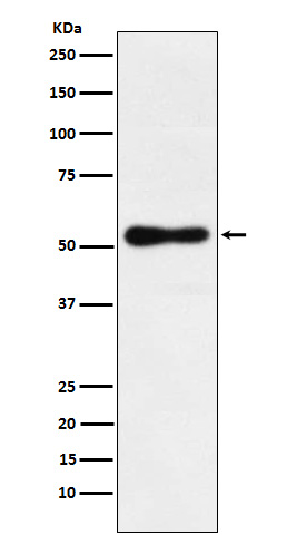 ROR beta Recombinant Rabbit mAb (一抗) - WB,Flow-Cyt | Bioss