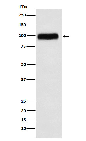 C1 Inactivator Recombinant Rabbit mAb (一抗) | Bioss