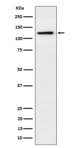 Palladin Recombinant Rabbit mAb (一抗) | Bioss