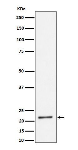 泛素蛋白（K27-linkage specific）重组兔单抗