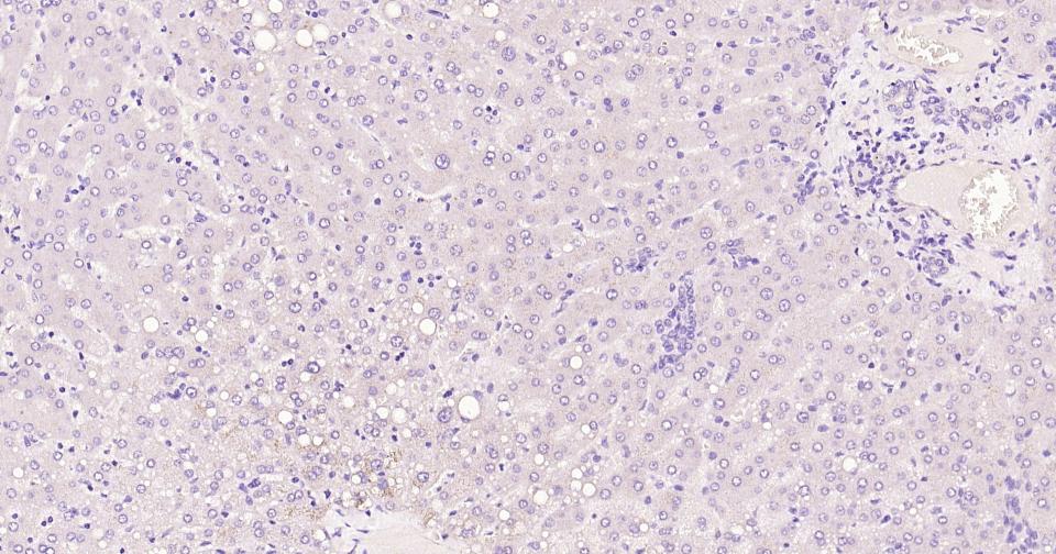 胶质纤维酸性蛋白单克隆抗体-bsm-42001M