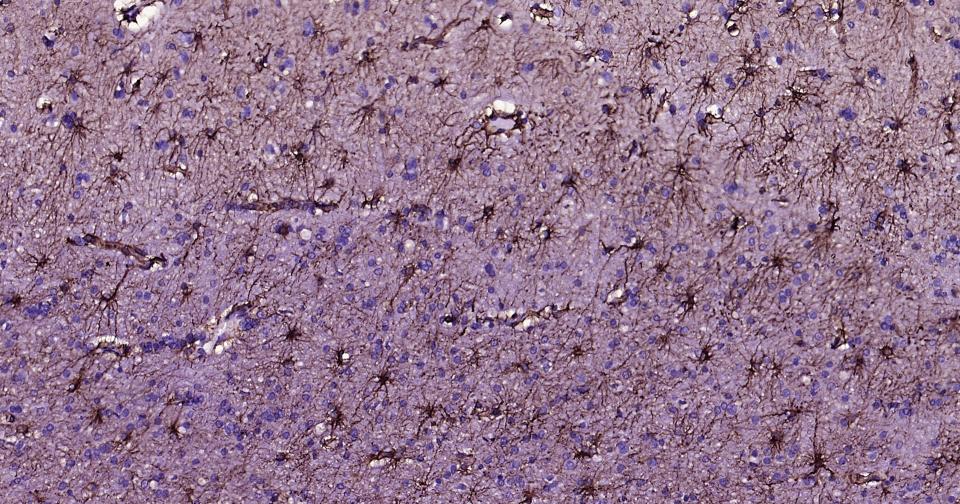 胶质纤维酸性蛋白单克隆抗体-bsm-41823M