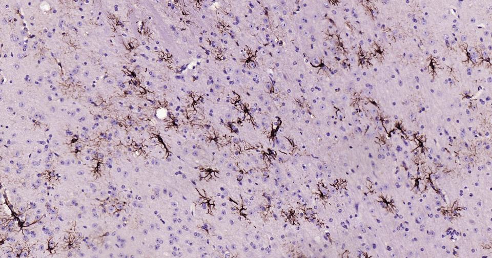 胶质纤维酸性蛋白单克隆抗体-bsm-42001M