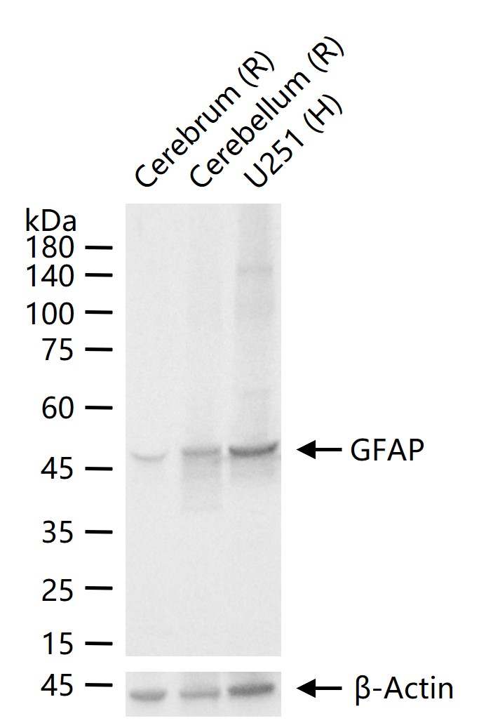 GFAP Mouse mAb (一抗) - WB,IHC-P,IHC-F,IF | Bioss