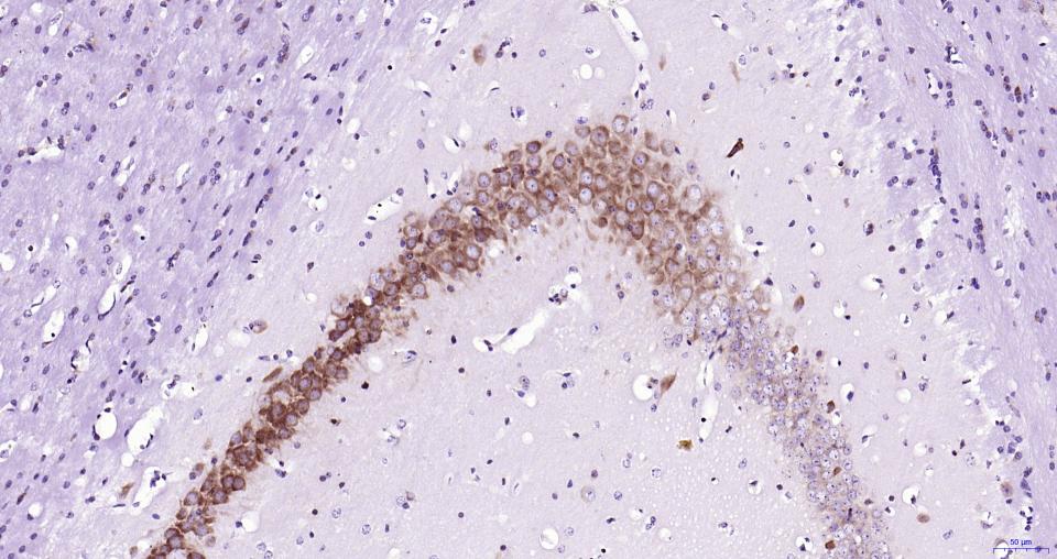 核因子2相关因子2重组兔单抗