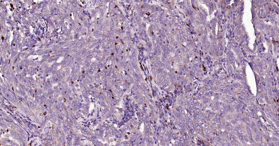 基质金属蛋白酶-9重组兔单抗